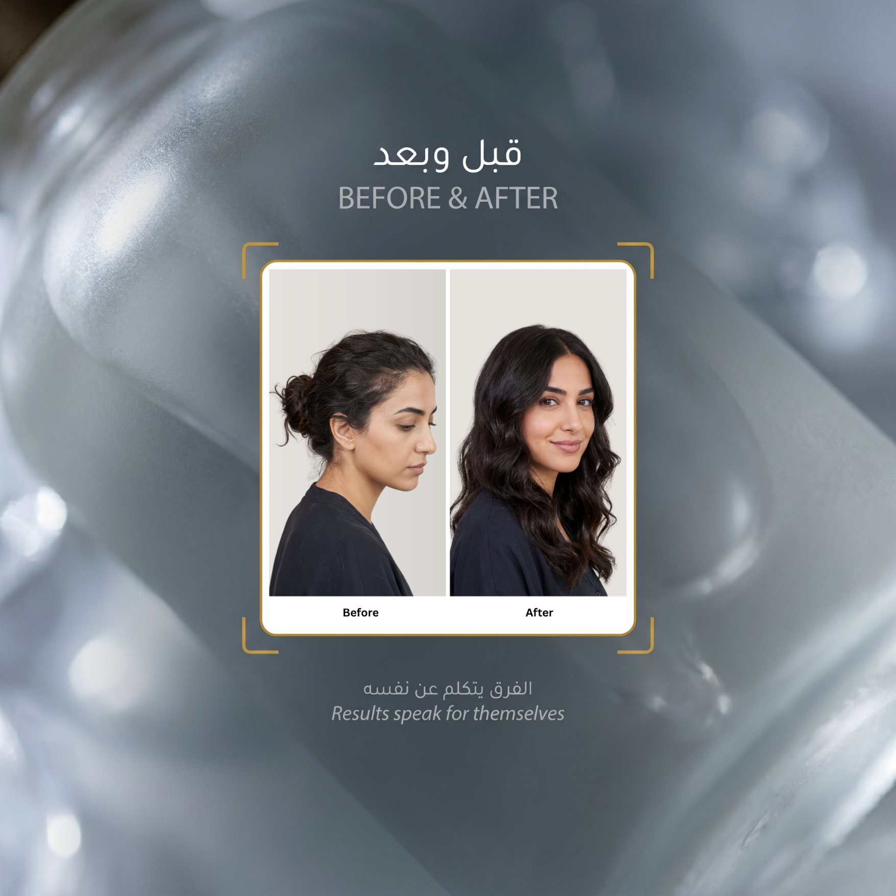 لومينيال 5 زيت الشعر بالمكونات التسعة